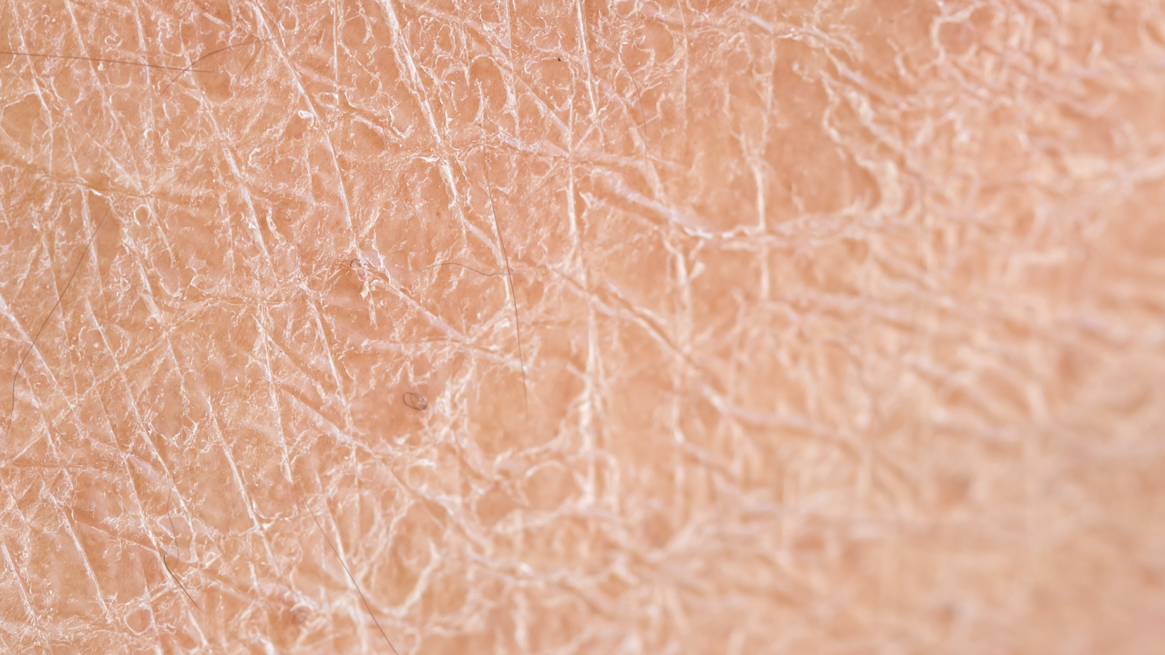 Mineral Makeup for Dry Skin: Hydration & Health Without Compromise