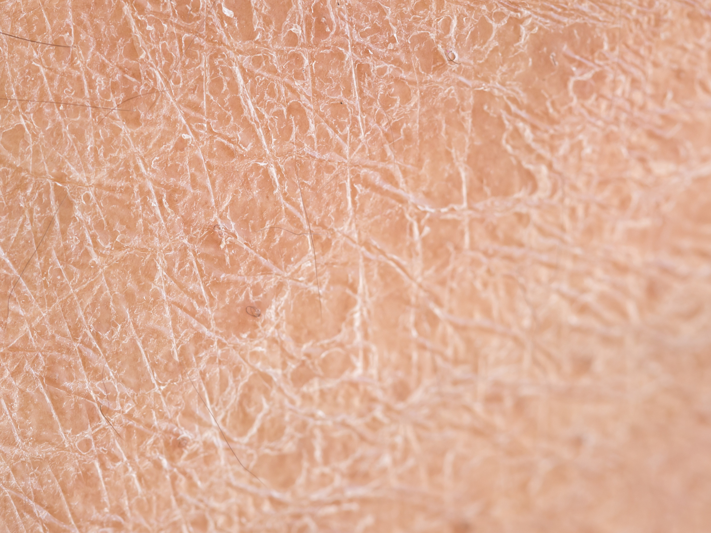 Mineral Makeup for Dry Skin: Hydration & Health Without Compromise