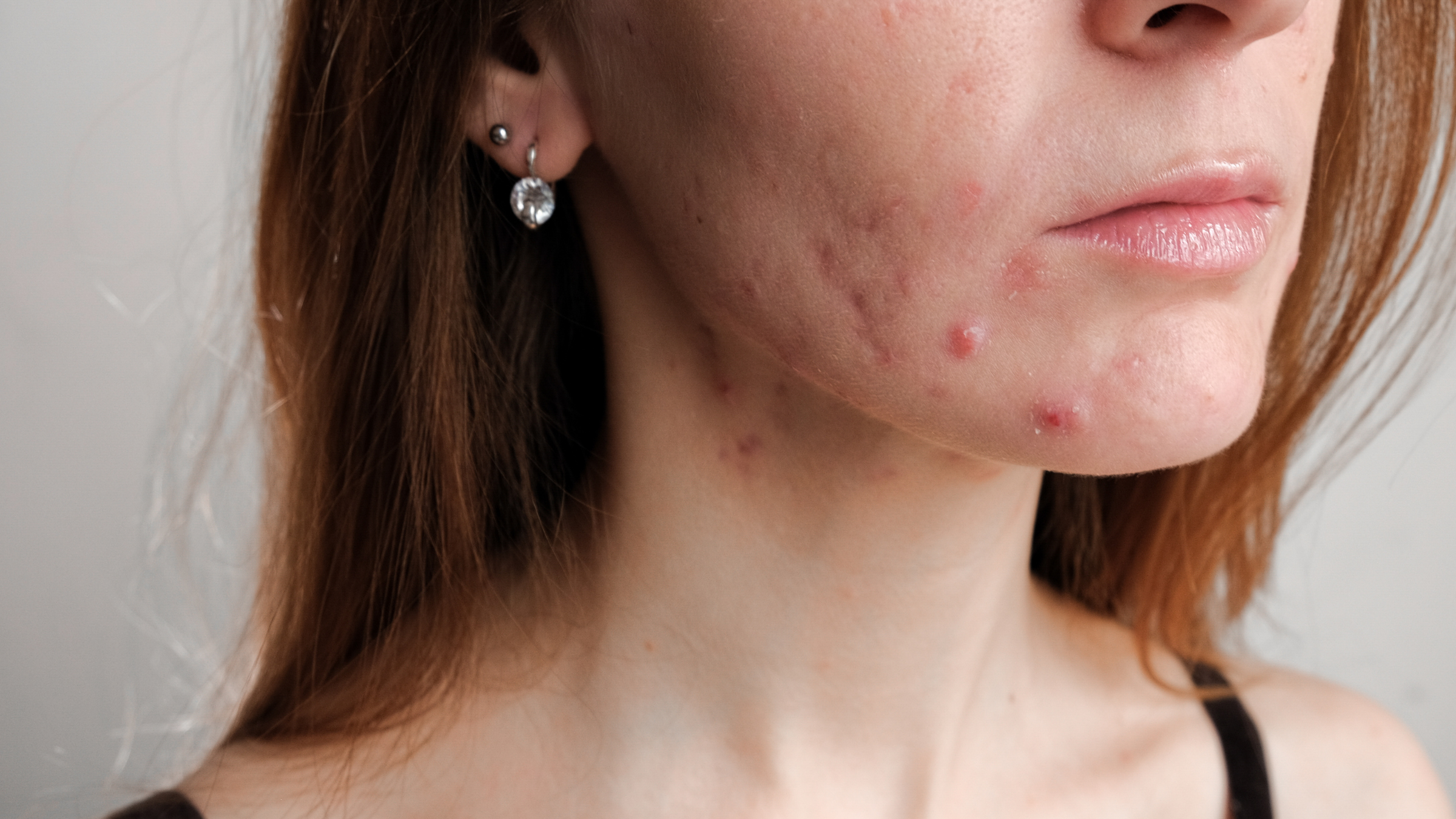 Your Foundation Is Making You Sick. (And It's Not Your Imagination.)