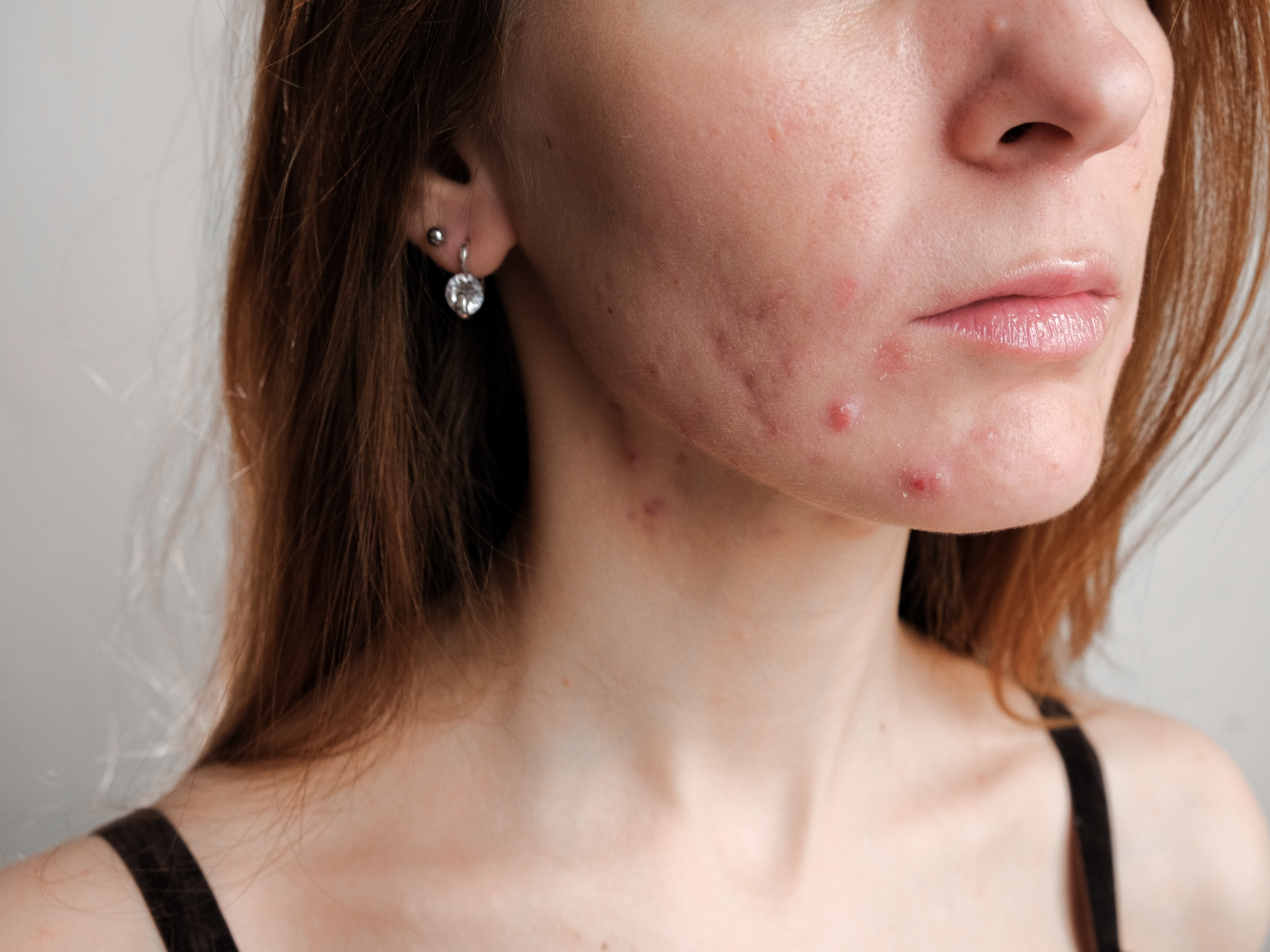 Your Foundation Is Making You Sick. (And It's Not Your Imagination.)