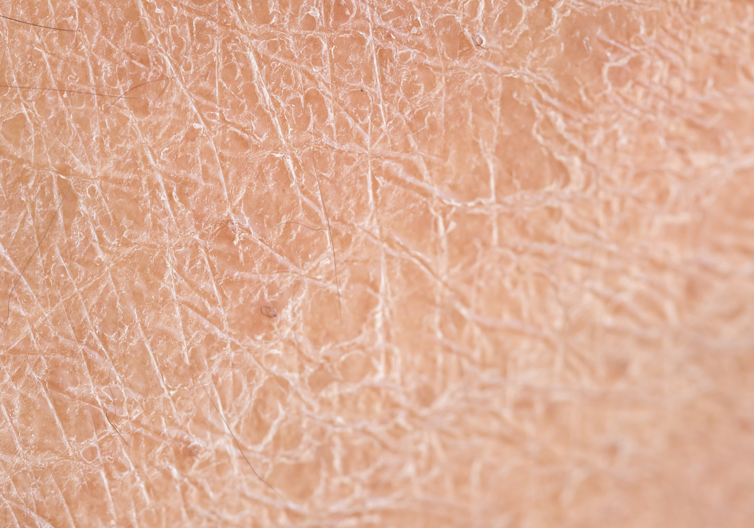 Mineral Makeup for Dry Skin: Hydration & Health Without Compromise